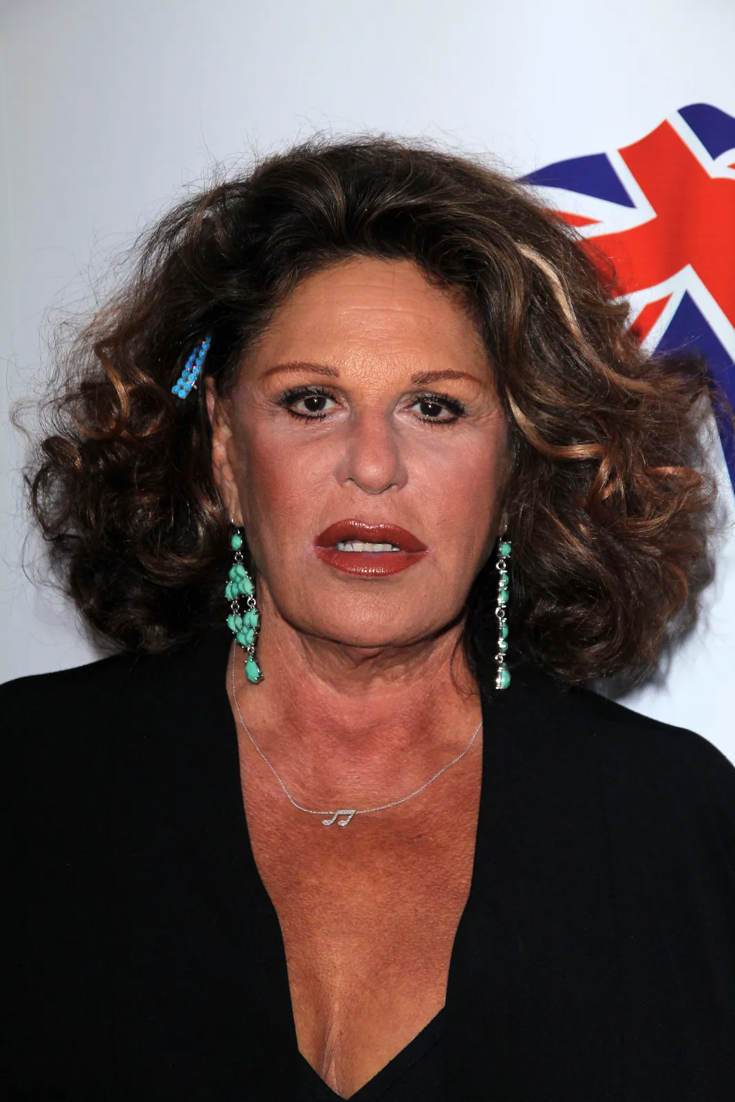 Forum on this topic: Lainie Kazan, lainie-kazan/ Discussion on this topic: Dana Andersen, lainie-kazan/